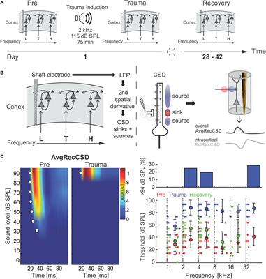 Acute and Long-Term Circuit-Level Effects in the Auditory Cortex After Sound Trauma